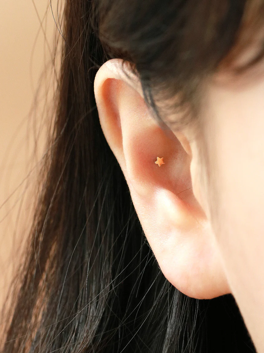 Thumbnail 13